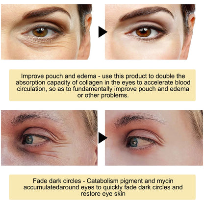 Moisturizing Eye Mask Patches – Dark Circle Removal &amp; Anti‑Wrinkle Treatment