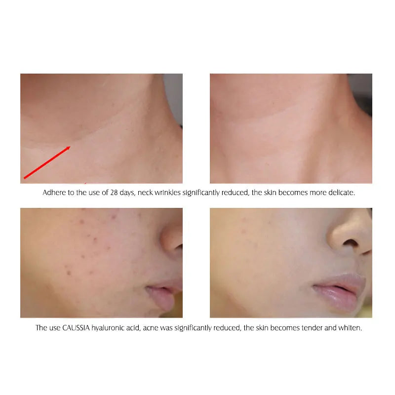 Hyaluronic Acid Serum VC Essence Face Cream Moisturizing Acne Aging & Wrinkles Repair 10PCS