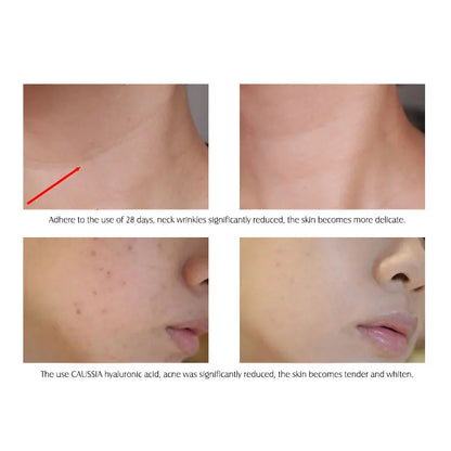 Hyaluronic Acid Serum VC Essence Face Cream Moisturizing Acne Aging & Wrinkles Repair 10PCS
