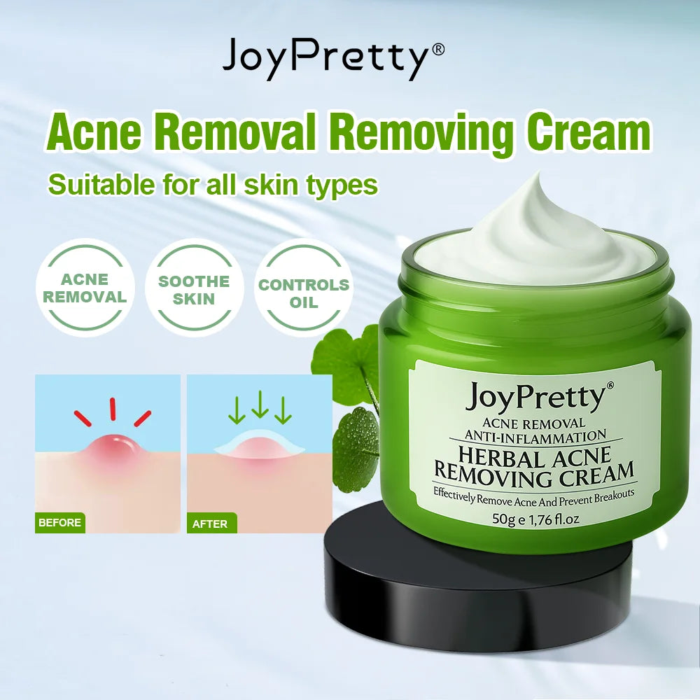Herbal Acne Treatment Cream – Pore Shrinking & Oil Control