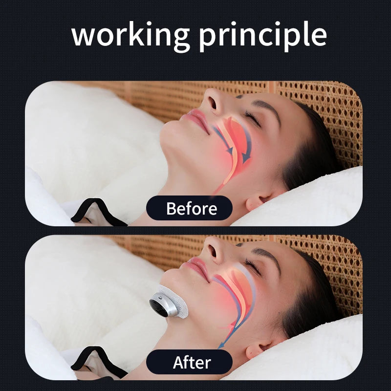 Anti-Snore Device with Dual-Pulse Stimulation - Sleep Apnea Relief, Snore Reduction,  Muscle Trainer for Silent Night