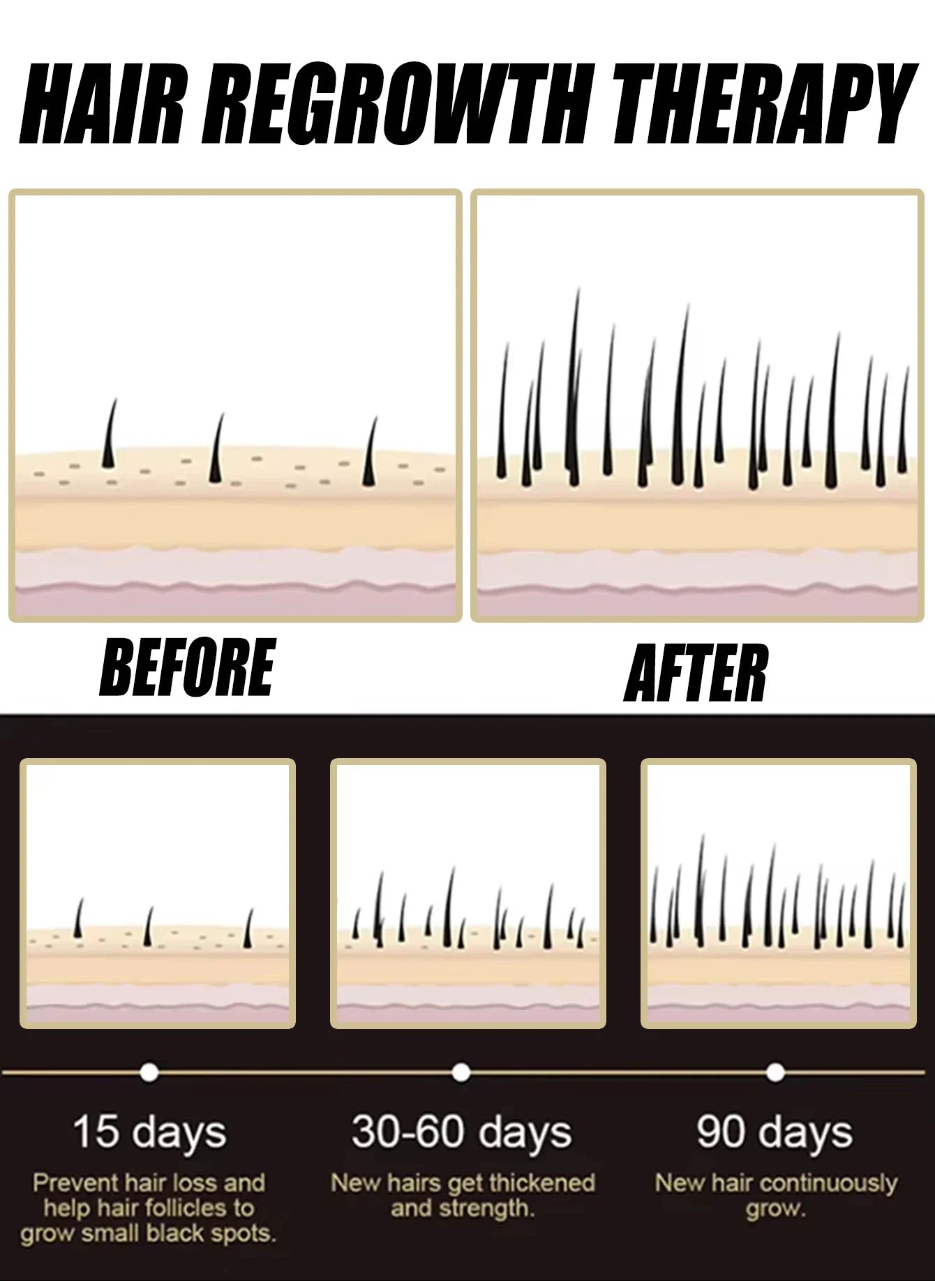 Anti-hair Loss Essence Promotes Hair Growth and Improves The Scalp Environment