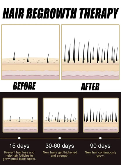Anti-hair Loss Essence Promotes Hair Growth and Improves The Scalp Environment
