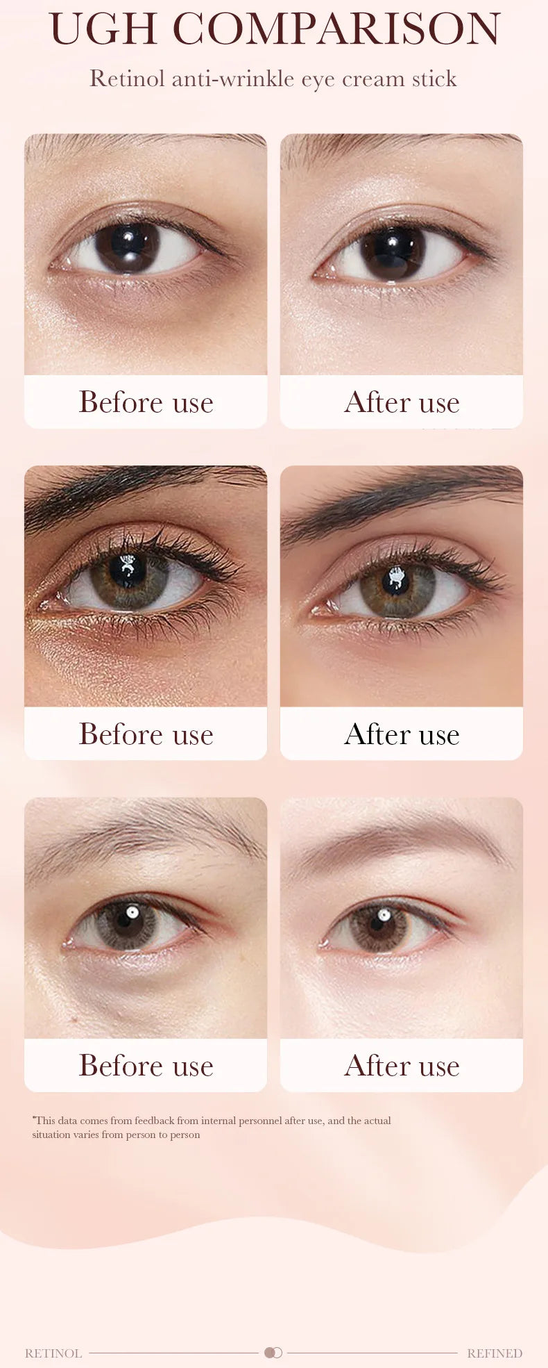 Retinol Eye Cream Stick Removing Anti Dark Circles Under the Eyes Moisturizing Firming Eyes Brighten Eye Skin Care Products