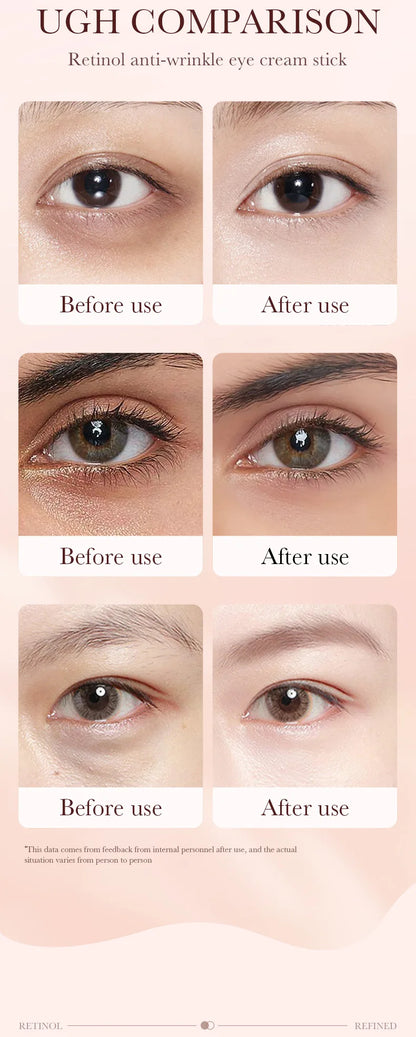 Retinol Eye Cream Stick Removing Anti Dark Circles Under the Eyes Moisturizing Firming Eyes Brighten Eye Skin Care Products