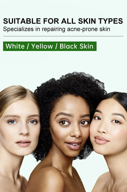 Herbal Acne Treatment Cream – Pore Shrinking & Oil Control
