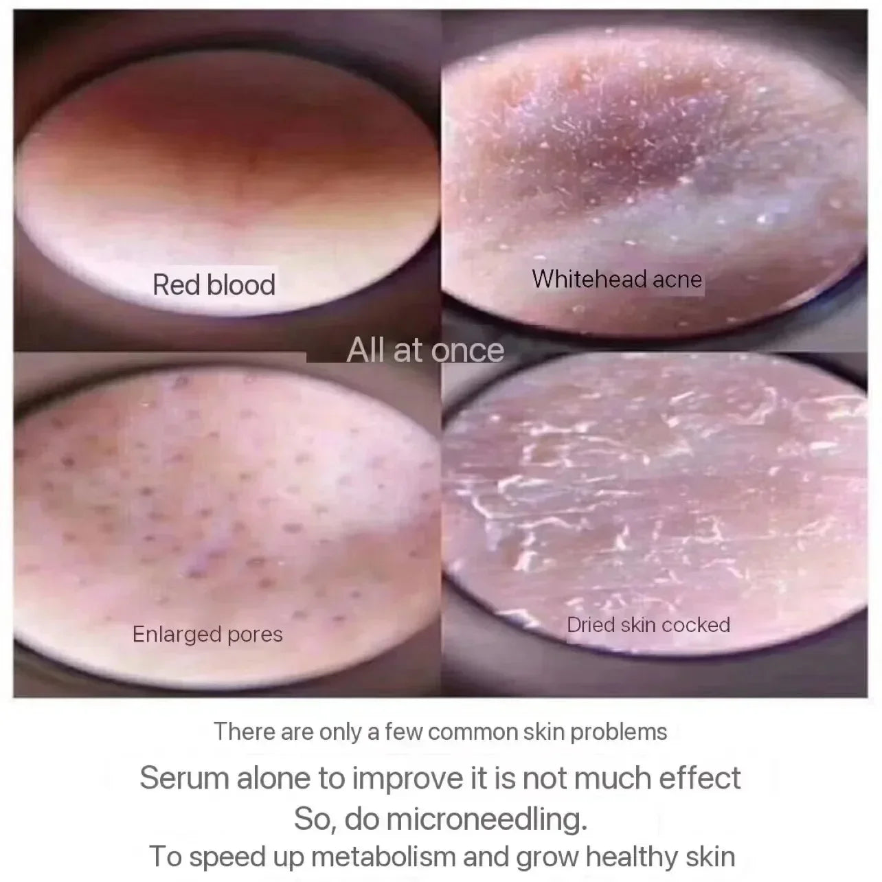 microcrystal sponge spicules for pore refining skincare
