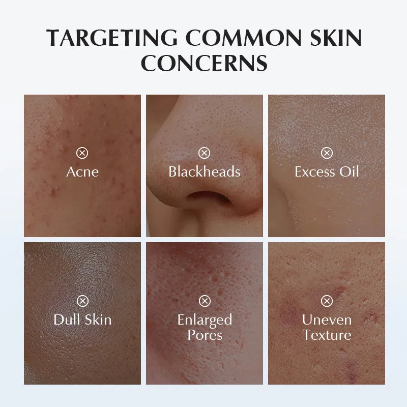 gentle cleanser for unclogging pores and brightening skin
