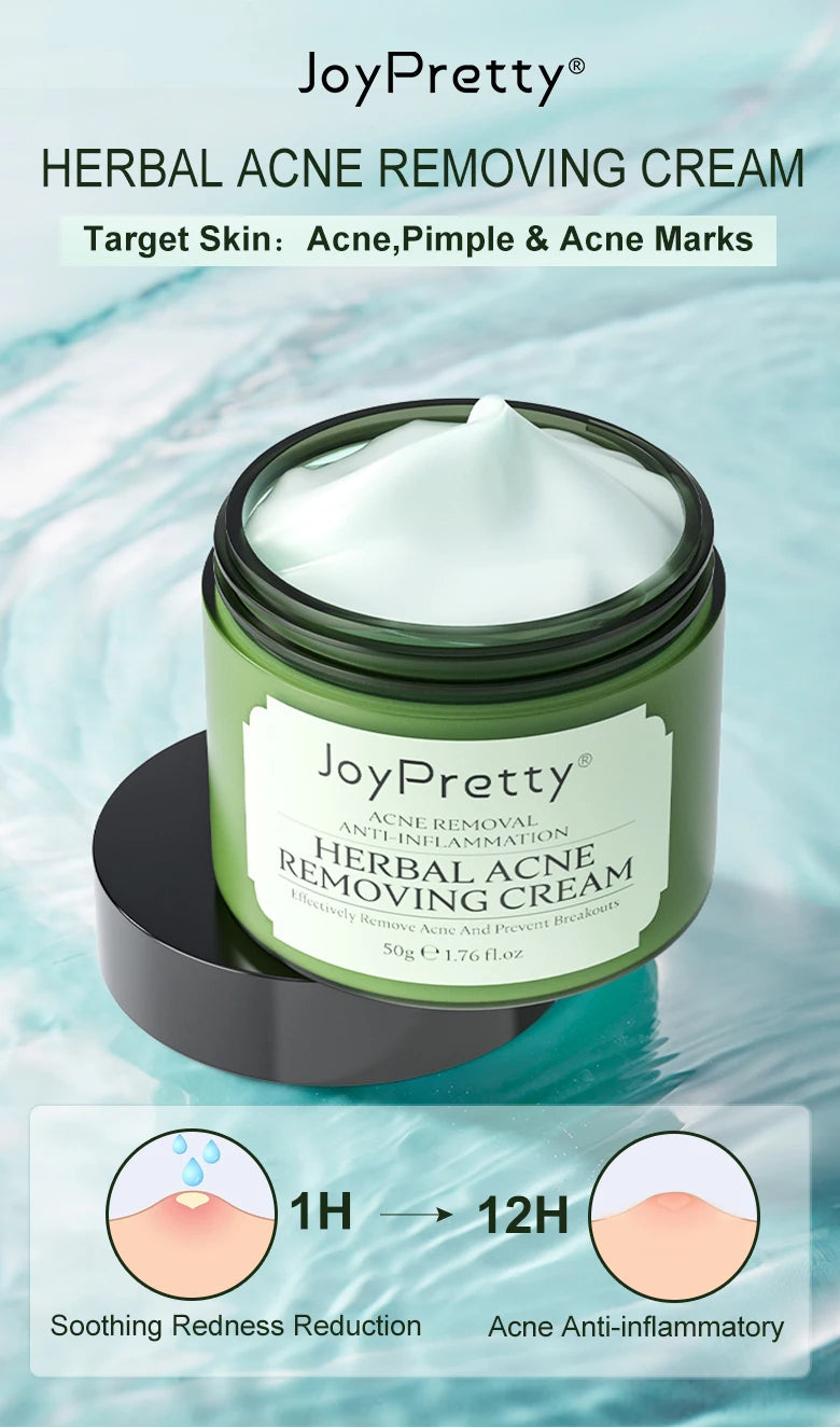 Herbal Acne Treatment Cream – Pore Shrinking & Oil Control