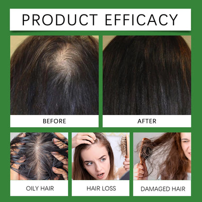 Rosemary Rice Water Hair Growth Spray with Peppermint Biotin Advanced Scalp Treatment for Thinning Hair Regrowth for Men & Women