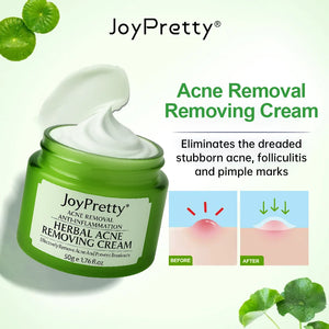 Herbal Acne Treatment Cream – Pore Shrinking & Oil Control