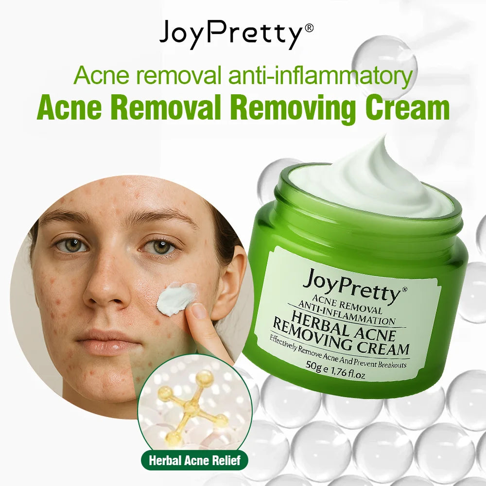 Herbal Acne Treatment Cream – Pore Shrinking & Oil Control