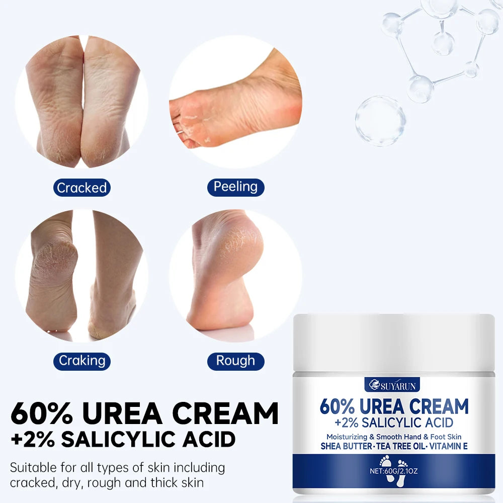 Foot Cream for Cracked Heels & Dry Skin - Intensive Moisturizing Treatment, Callus Remover, Diabetic Foot Care.
