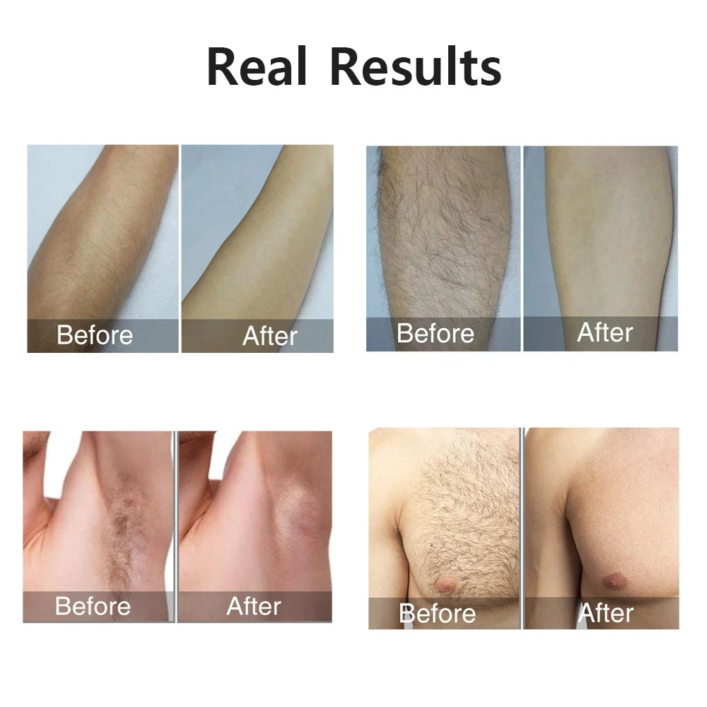 at home hair removal device for long lasting results
