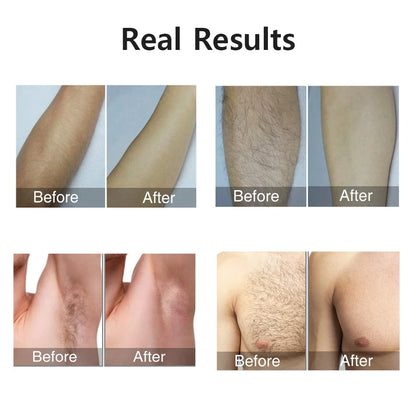 at home hair removal device for smooth skin treatment
