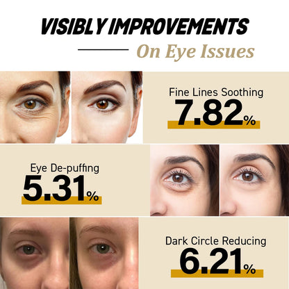 Snail Collagen Eye Cream Stick – Anti‑Wrinkle, Dark Circle Brightening & Firming Treatment