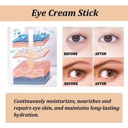 Snail Collagen Eye Cream Stick – Anti‑Wrinkle, Dark Circle Brightening & Firming Treatment