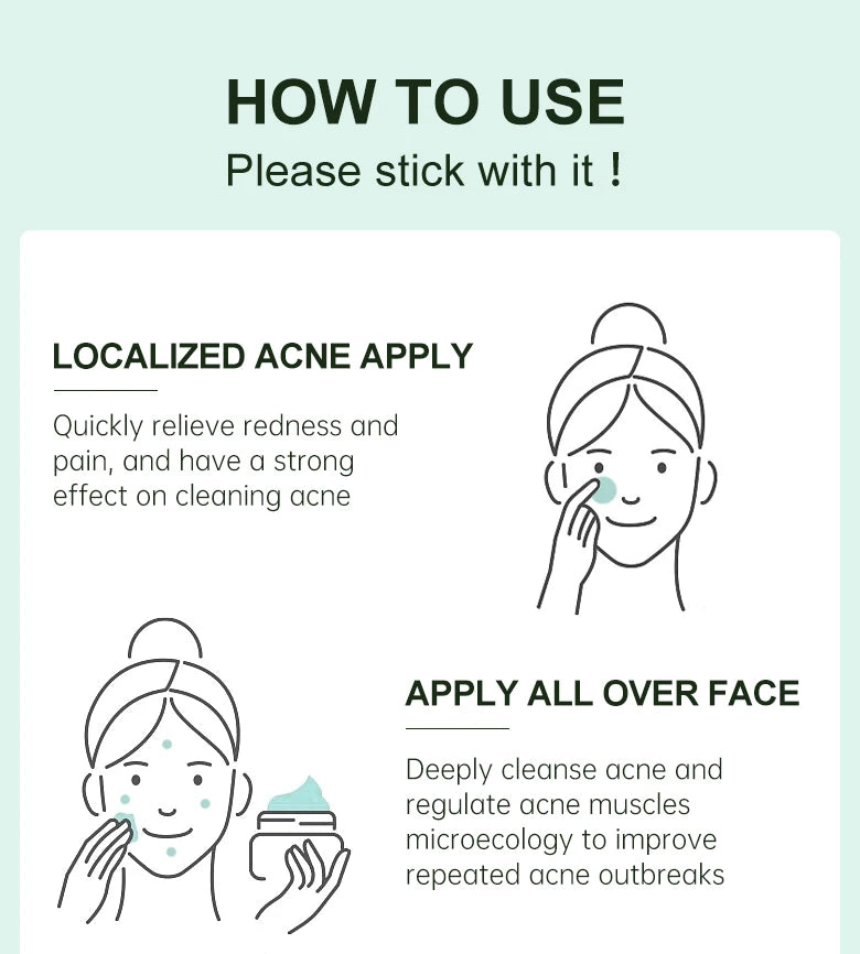 Herbal Acne Treatment Cream – Pore Shrinking & Oil Control