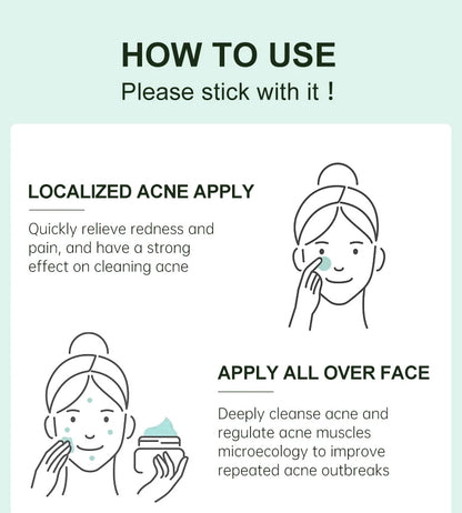 Herbal Acne Treatment Cream – Pore Shrinking & Oil Control