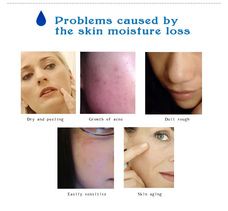 Hyaluronic Acid Serum VC Essence Face Cream Moisturizing Acne Aging & Wrinkles Repair 10PCS