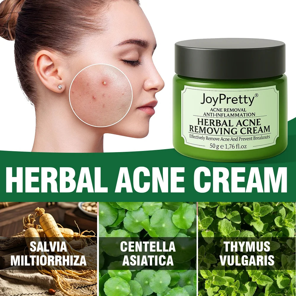 Herbal Acne Treatment Cream – Pore Shrinking & Oil Control