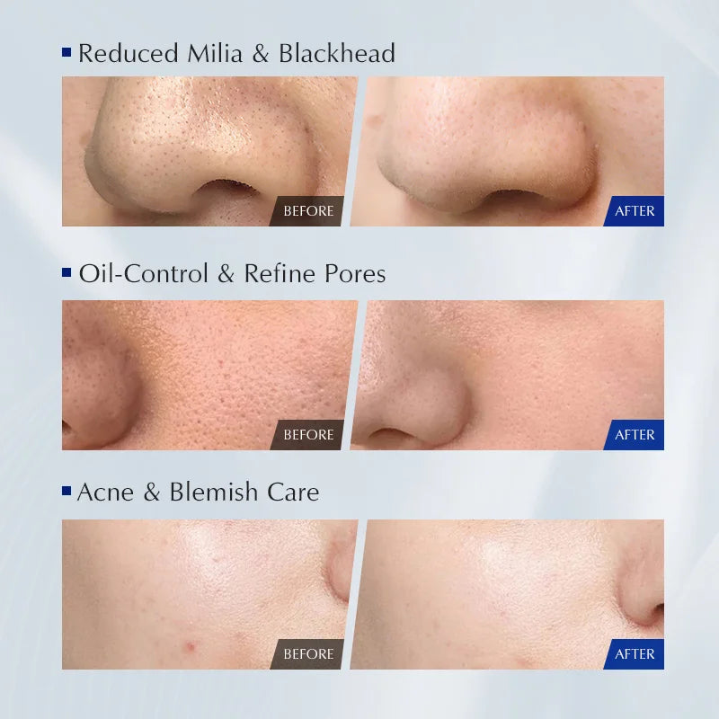 niacinamide face wash for smooth clear even skin tone
