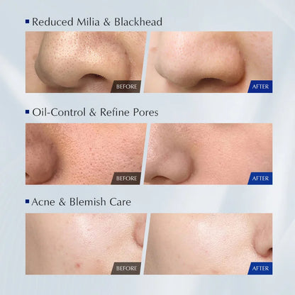 niacinamide face wash for smooth clear even skin tone

