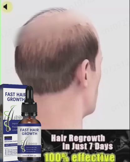 Anti-hair Loss Essence Promotes Hair Growth and Improves The Scalp Environment