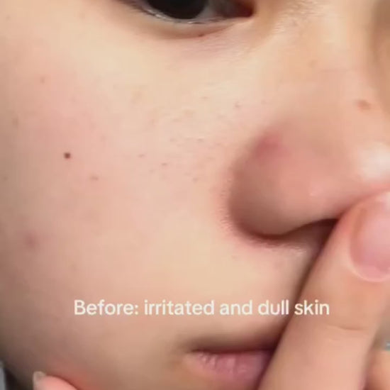korean skincare set for brightening and barrier repair care
