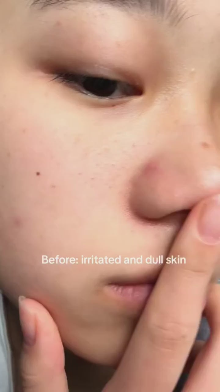 korean skincare set for brightening and barrier repair care
